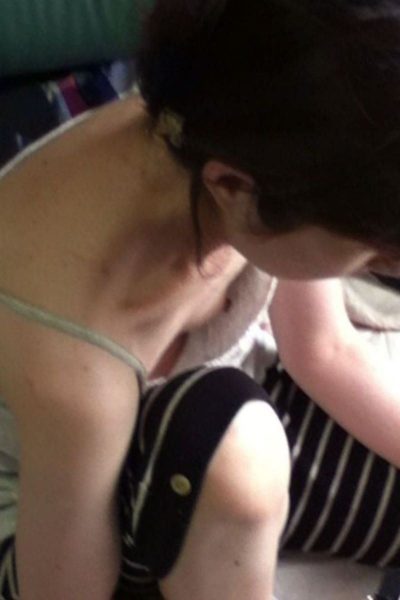 nipple accident 4028 136 R 1 400x600 - nipple_accident-4028-136_R-1